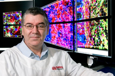 Professor Nigel McMillan from the Griffith Health Institute