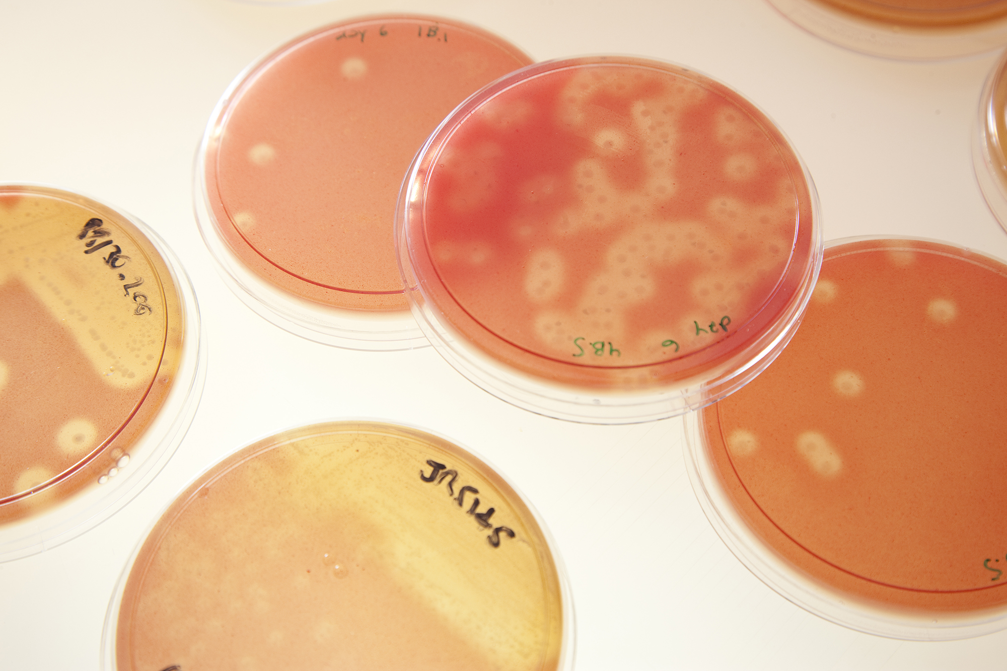 The importance of listing Strep A as a Neglected Tropical Disease