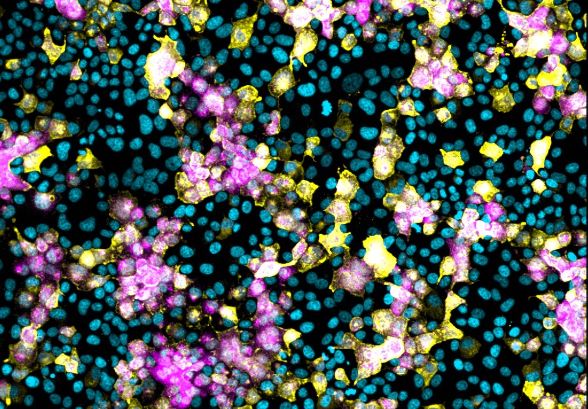 Microscopy image of the fluorescent SARS-CoV-2 virus (in pink) engineered by Griffith University and University of Tartu researchers showing infected cells.