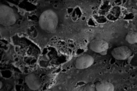 “A scanning electron microscopy image are presented showing the morphology and size of the anti-viral exosomes