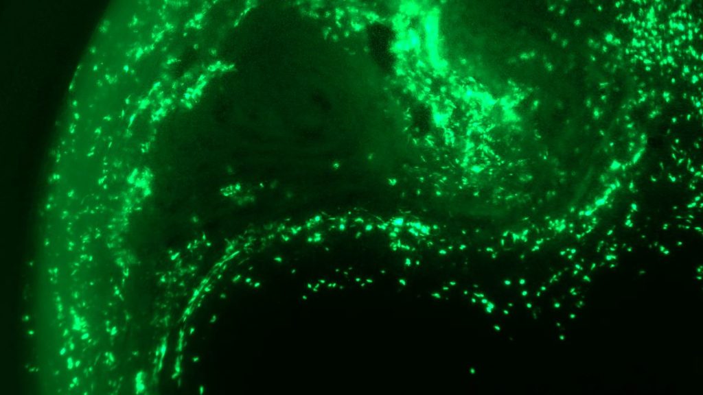 Human metapneumovirus Griffith News